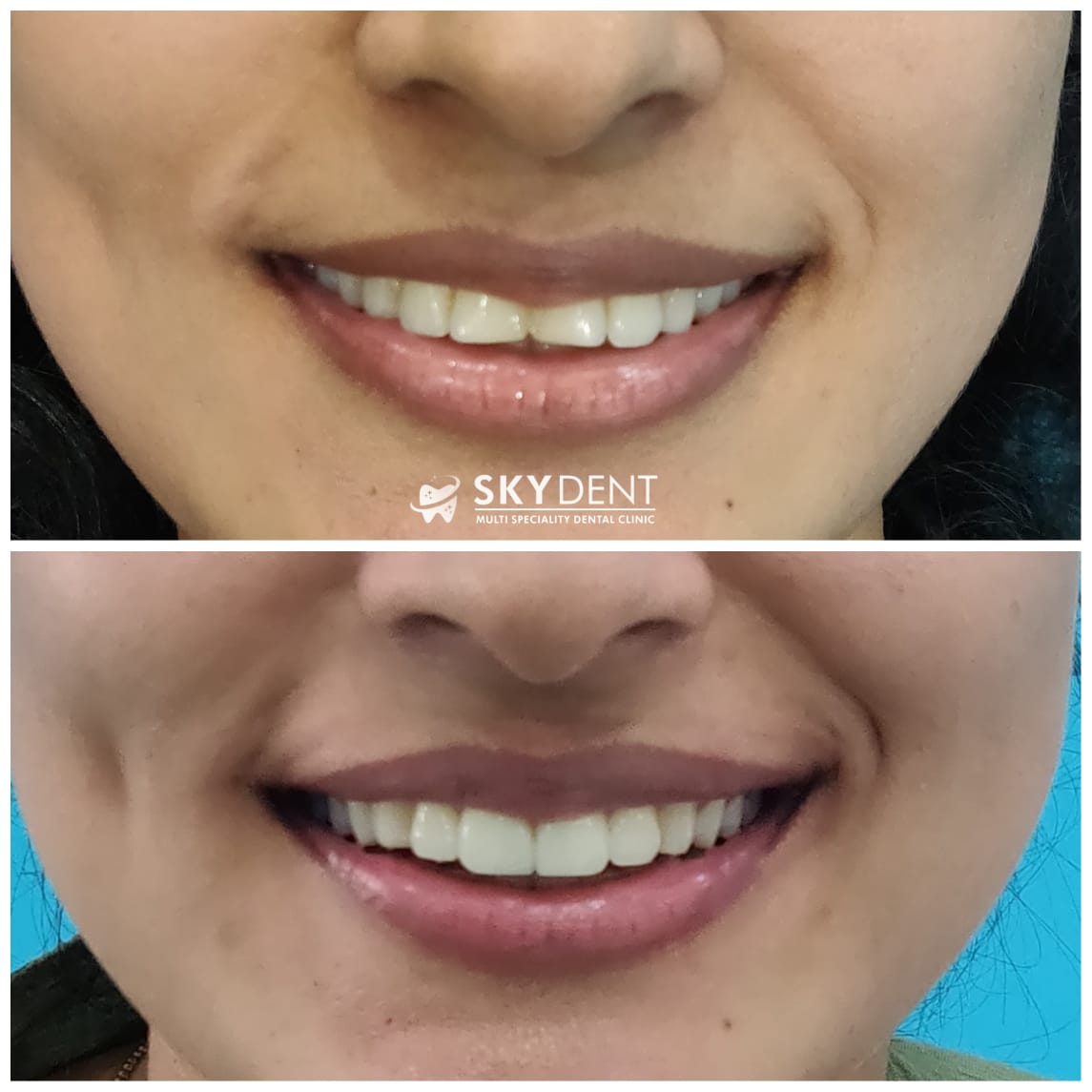 SKY DENT MULTI SPECIALITY DENTAL CLINIC NADAPURAM