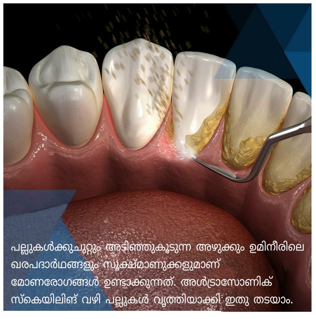 SKY DENT MULTI SPECIALITY DENTAL CLINIC NADAPURAM